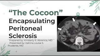 Jan 2025 - OSEA PD Case Study:  The Coccon: EPS Encapsulating Peritoneal Sclerosis
