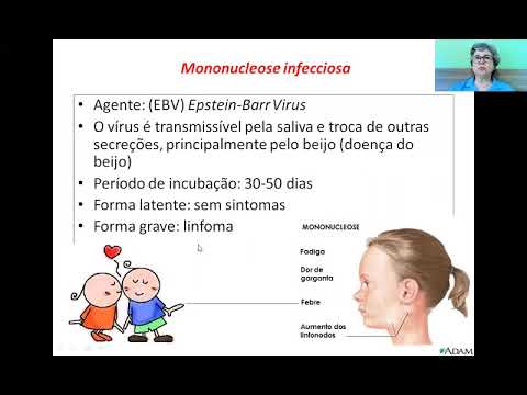 Aula Síndrome da Mononucleose Infecciosa