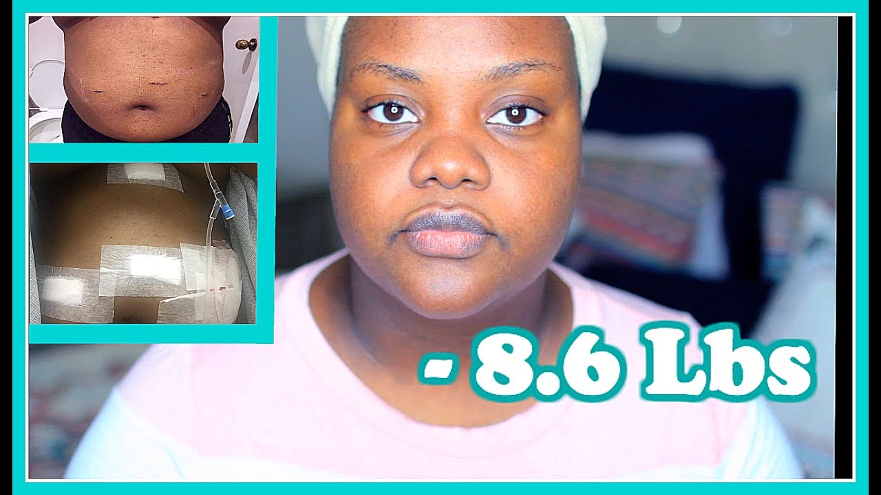 Weight loss vancouver washington picture 4