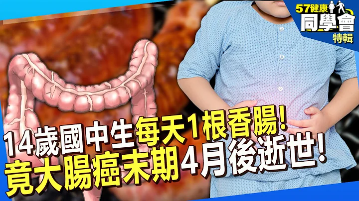 【精選】14歲國中生每天1根香腸「竟大腸癌末期」4月後逝世！台南男狂喝牛肉湯也罹癌「紅肉比抽煙毒」【57健康同學會】 - 天天要聞