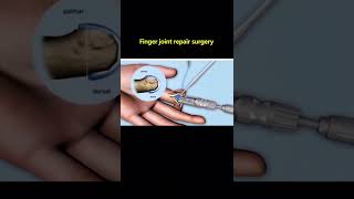 Celebrity #1 Respect the Surgical Tech #Shorts #funny #doctor Profile