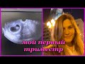 ПЕРВЫЙ ТРИМЕСТР БЕРЕМЕННОСТИ🤰🏻 | планирование | как мы рассказали родителям