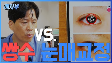 쌍수와 눈매교정 결정하는 기준