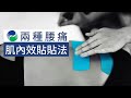 兩種腰痛的肌內效貼貼法 【肌貼】| Low Back Pain Taping