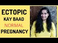 Ectopic Kay Baad Pregnant Kaise Ho || Ectopic Pregnancy || Ek Tube Kay Saath Baccha Ho sakta hai