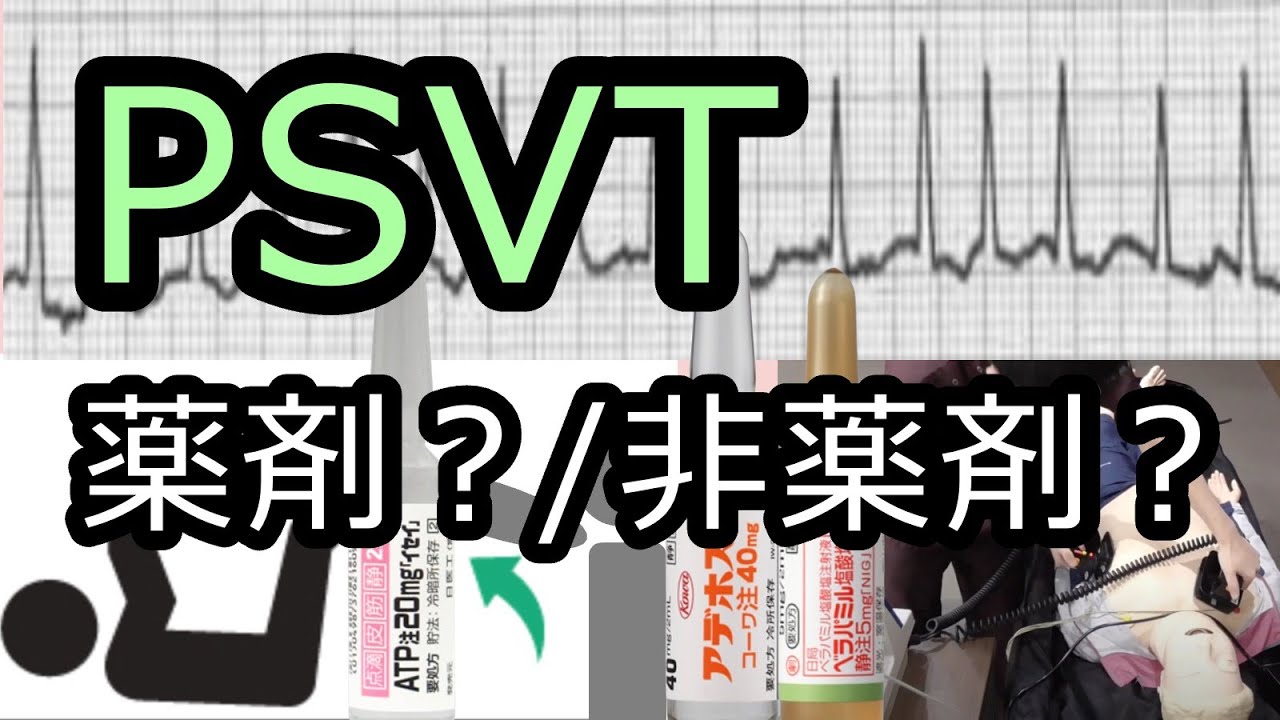 PSVT[発作性上室頻拍]の治療の手技と薬は？