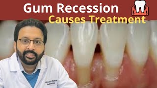 What Causes Gum Recession | How To Treat Receding Gums