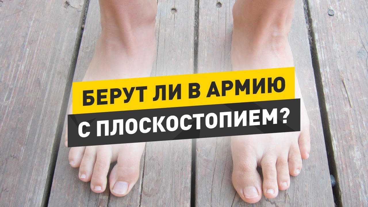 Берут ли в армию с плоскостопием? Как получить военный билет по ...