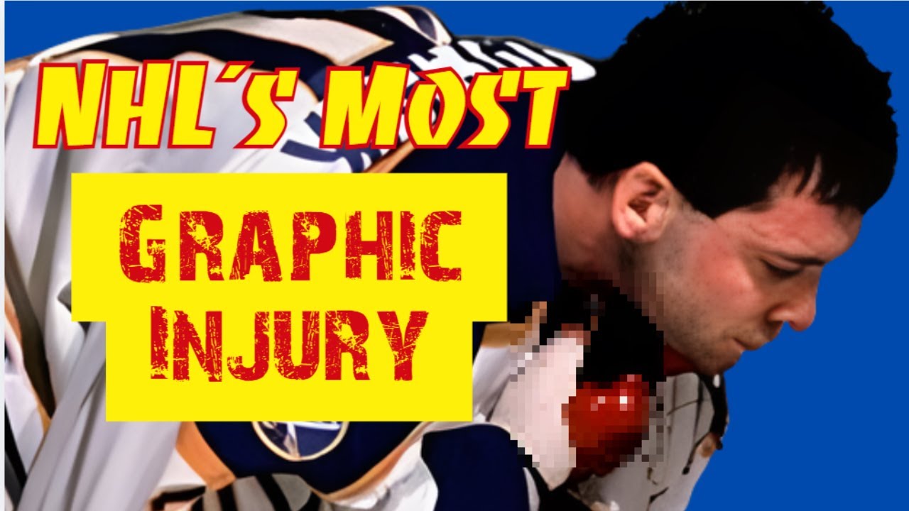 Clint Malarchuk: The Most Graphic Injury in NHL History | A Slashed Throat on Live TV