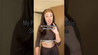 My Skincare Routine For Perioral Dermais