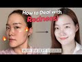 How to PORPERLY deal with redness🔥