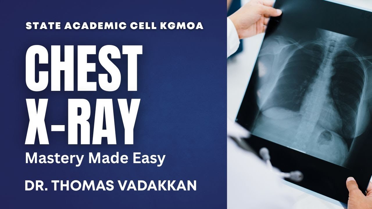 Chest X-Ray Mastery Made Easy | KGMOA Academic Cell Webinar