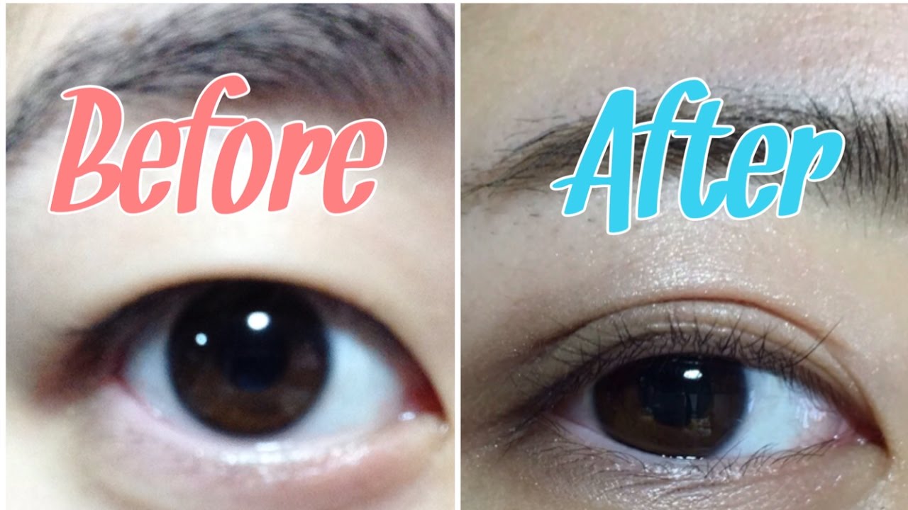 私の腫れぼったい一重 奥二重 を100円で二重にする方法 No Surgery Double Eyelid 쌍커풀 만드는 법 Youtube