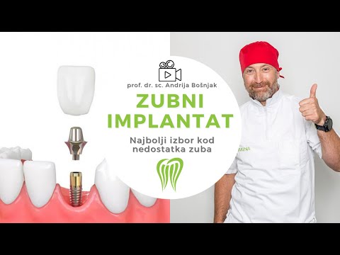 ZUBNI IMPLANTATI KAO NAJBOLJI IZBOR KOD NEDOSTATKA ZUBA - prof. dr. sc. Andrija Bošnjak