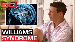 The rare disorder that could hold the secret of what makes us who we are | 60 Minutes Australia