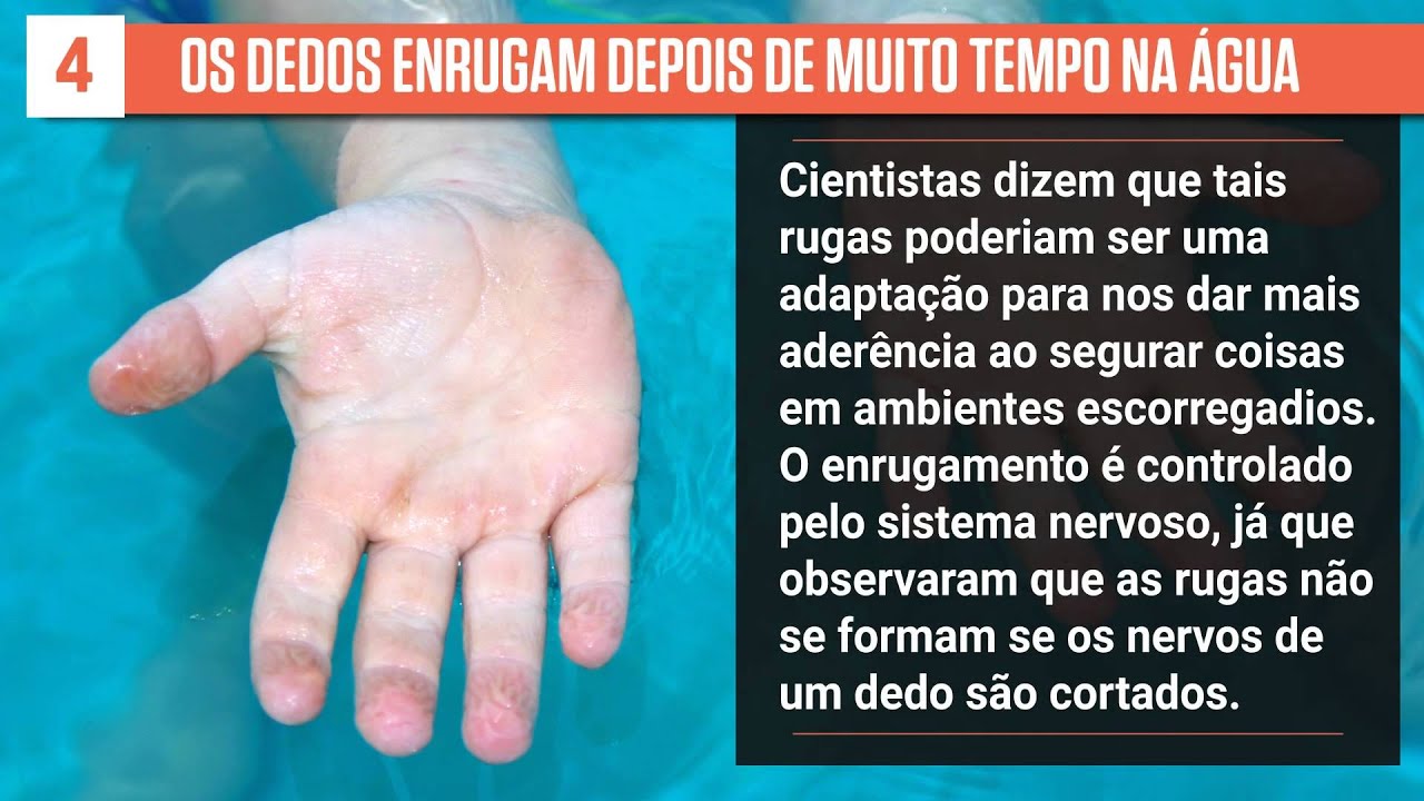 5 bizarrices do corpo humano - e o que elas significam - #Superlistas curiosidades de cuba