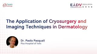 Cryosurgery and Imaging Techniques in Dermatology | Frontline Focus | EADV 2025