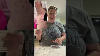 Impetigo and night meds