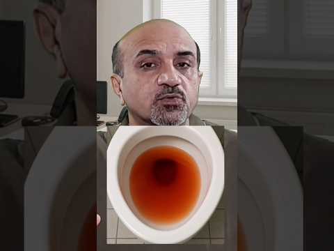 3 Early Signs Of Kidney Disease گردے کی بیماری کی تین ابتدائی علامات 