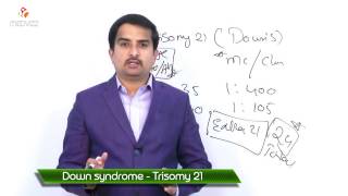 Down's syndrome - Trisomy 21  ( Usmle quick review )