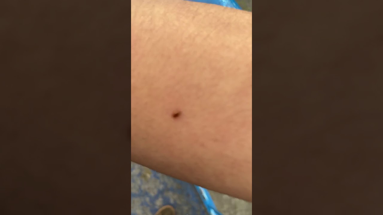 YouTubeでbugsを視聴 YouTubeでbugsを視聴