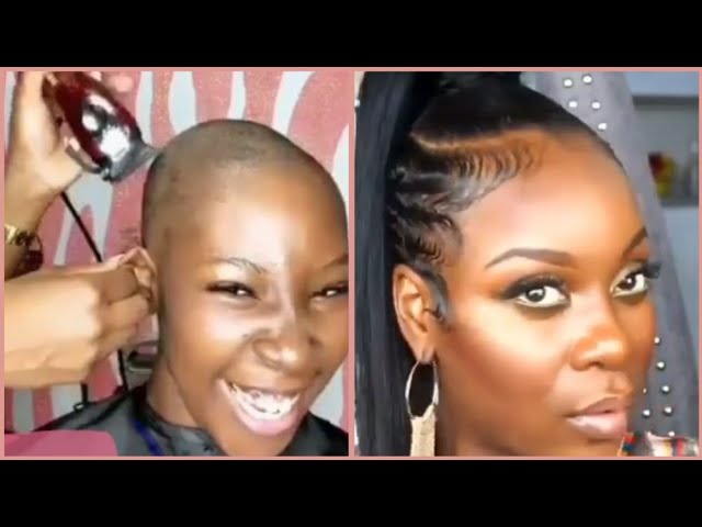 Featured image of post Black Hairstyles To Cover Alopecia : You can use this hairstyle guide for bantu people is the generic name for 300+ ethnic groups in africa, which covers a large geographical it&#039;s important to note that a common type of hair loss, called traction alopecia, can be caused by braids.