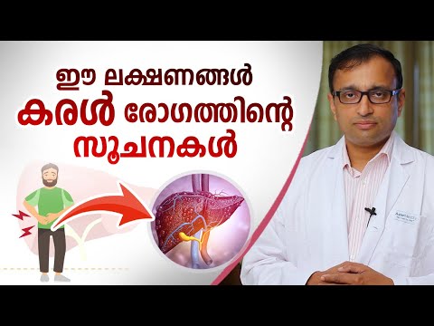 ഈ ലക്ഷണങ്ങൾ കരൾ രോഗത്തിന്റെ സൂചനകൾ | Liver Disease Malayalam | Arogyam
