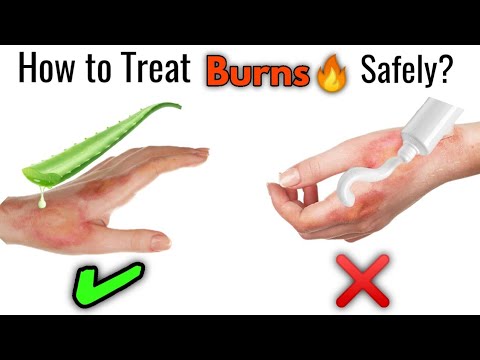 How to Treat Burn at Home? || Types of Burns