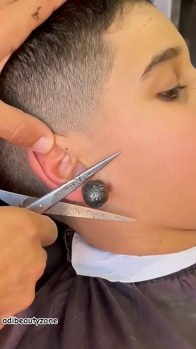 Skincare Routine For Boy #adi #shorts