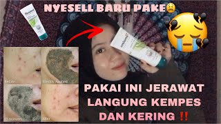 MASUK SAMPAI KE PORI”😱 || REVIEW HIMALAYA NEEM MASK
