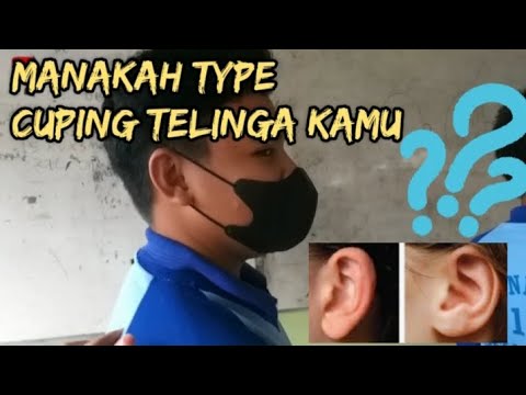 Video: Adakah cuping telinga yang melekat genetik?