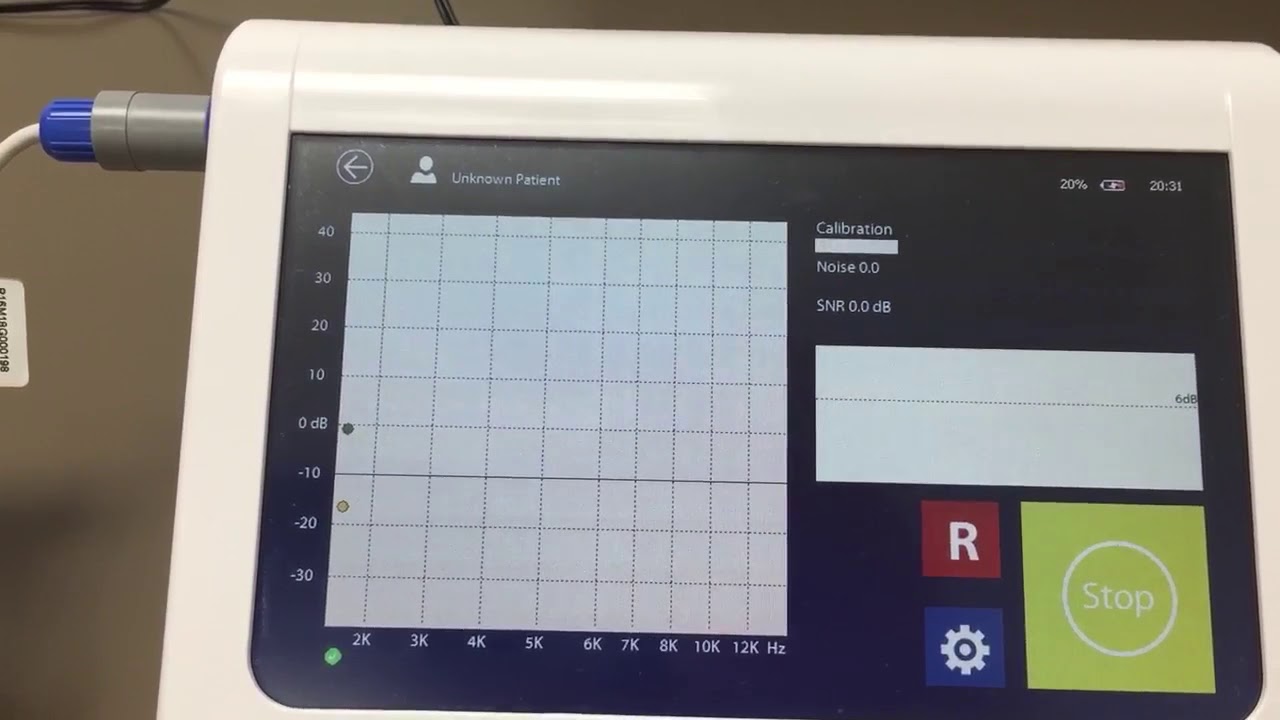 Resonance R16M D+ Portable Diagnostic Tympanometer and DPOAE. - YouTube