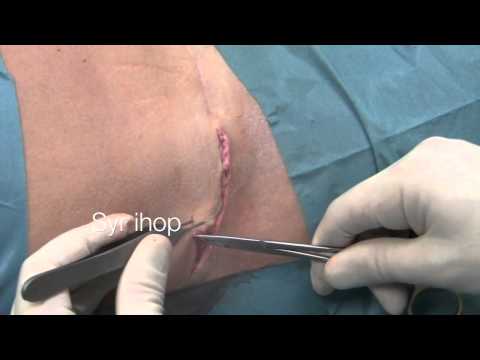 Video: Plastikkirurgi For Dyr