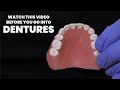 Watch this video BEFORE you go into a denture.