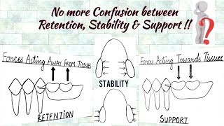 Understanding the concept of Retention, Stability and Support in Prosthodontics screenshot 5