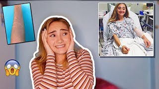 WHAT HAPPENED TO MY ARM?!