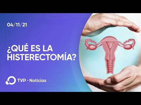 Video: ¿Qué significa uretrectomía?
