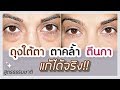 วิธีลดถุงใต้ตา รอยคล้ำใต้ตา ลดริ้วรอยใต้ตา ตีนกาแก้ได้!! เห็นผลจริง | สวยสุขภาพดี