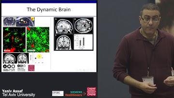 Diffusion beyond the tensor and it