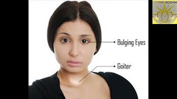 Light language for healing hyperthyroidism