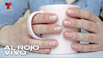 ¿Qué aspecto tienen las uñas anémicas?