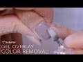 Gel Overlay Color Removal