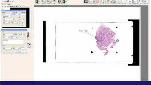 Whole Slide Imaging: Annotation (MikroScan D2)