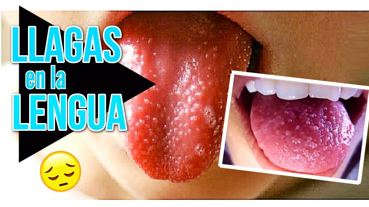 Que significa sacar la lengua