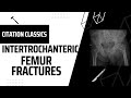 Trauma citation classics 09 intertrochanteric femur fractures