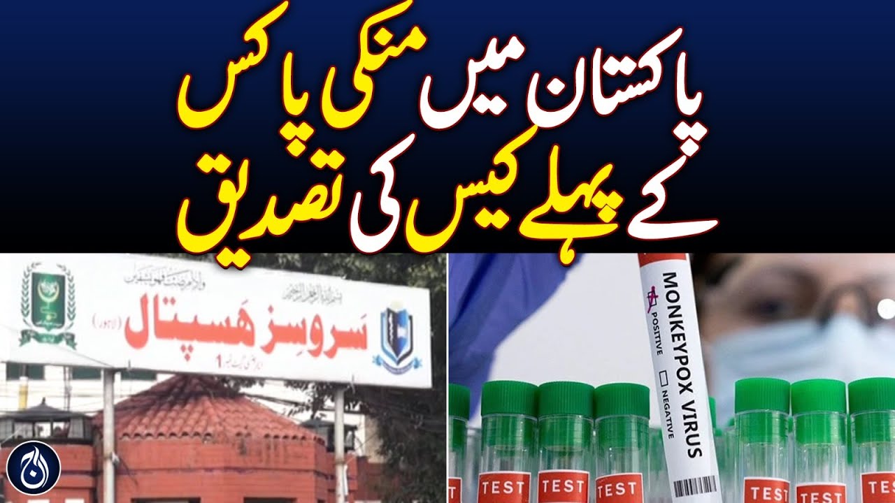 First case of monkeypox confirmed in Pakistan - Aaj News - YouTube