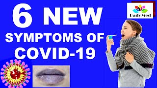 COVID-19 Update: 6 New Symptoms of COVID-19 | Symptom list for COVID-19 has been expanded |Daily MED