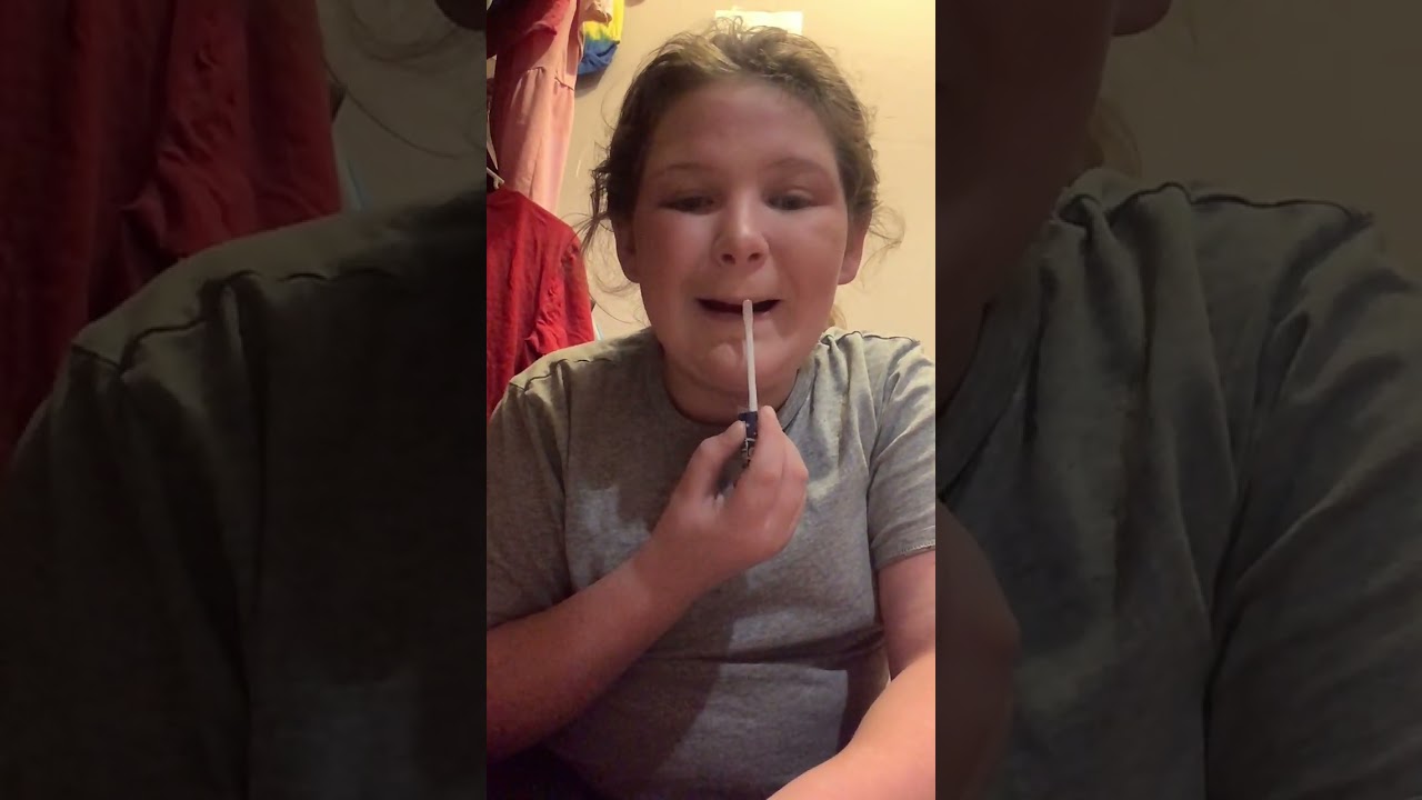 Hey I got hurt in this video………. Looooook…….