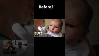 Speedy Tongue Tie Release: Diamond Cut Opening in 10 Seconds! #pediatrician #baby #doctor