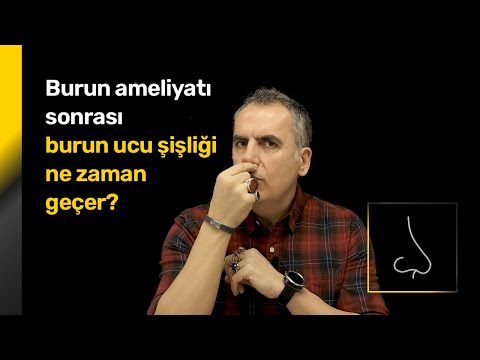 Video: Burnum şişirmi?